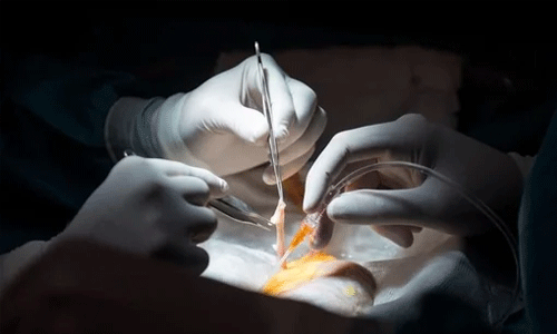 മൂക്കില്‍ ശസ്ത്രക്രിയ നടത്തി,യുവതിയുടെ കാഴ്ച നഷ്ടമായി; മുഖ്യമന്ത്രിക്കും ആരോഗ്യമന്ത്രിക്കും പരാതി