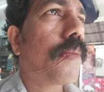 റോഡിന് കുറുകെ കെട്ടിയ കേബിള്‍ കഴുത്തില്‍ കുരുങ്ങി ബൈക്ക് യാത്രികന് പരിക്ക്