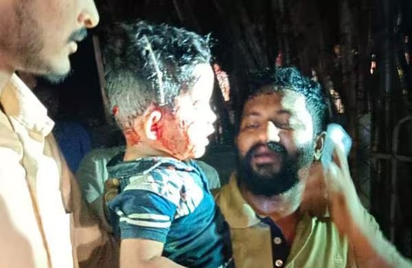 തിരുപ്പതിയില്‍ ദര്‍ശനത്തിന് എത്തിയ മൂന്നുവയസുകാരനെ പുലി കടിച്ചു; ഗുരുതര പരിക്ക്