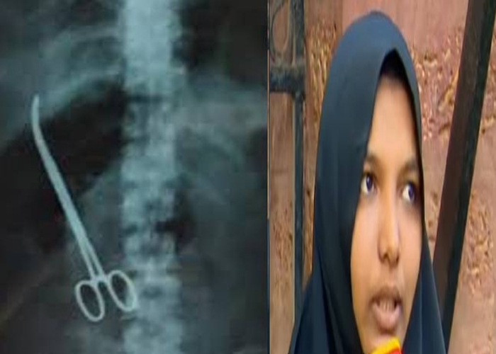 വയറ്റിൽ കത്രിക കുടുങ്ങിയ സംഭവം: ശസ്ത്രക്രിയ ചെയ്ത ഡോക്ടർമാരും നഴ്സുമാരും പ്രതികളാകും