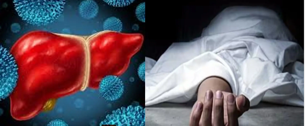 വൈറൽ ഹെപ്പെറ്റൈറ്റിസ് ബാധ: ചികിത്സയിലുണ്ടായിരുന്ന ഒരാൾ കൂടി മരിച്ചു, മരണസംഖ്യ മൂന്നായി