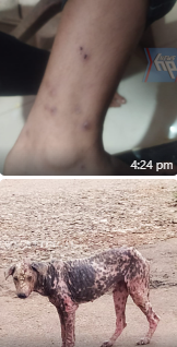 ആറ്റിങ്ങൽ നഗരത്തിൽ തെരുവ് നായ്ക്കൾക്കിടയിൽ അപൂർവ്വ ചെള്ള് രോഗം പടർന്നു പിടിക്കുന്നു; രക്ഷകർത്താക്കൾ ആശങ്കയിൽ