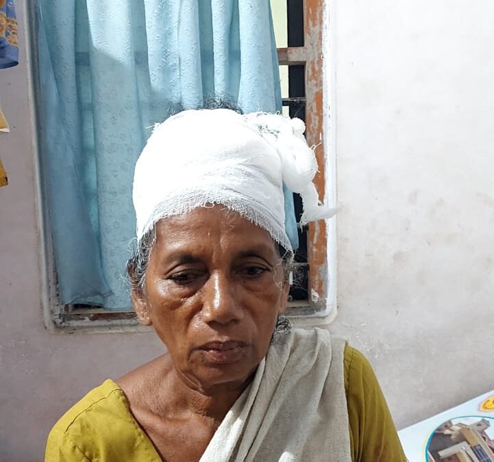 തൊഴിലുറപ്പ് തൊഴിലാളിയുടെ തലയിൽ തേങ്ങ വീണു ഗുരുതര പരിക്ക്