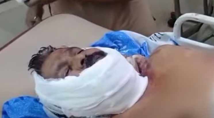ഭര്‍ത്താവിനെ വെട്ടിക്കൊല്ലാന്‍ ശ്രമിച്ച് ഭാര്യ; കുളത്തില്‍ ചാടി ആത്മഹത്യാശ്രമം