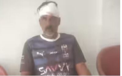വൈദ്യുതി പോസ്റ്റിൽ നിന്നും ക്ലാമ്പ് ഇളകി തലയിൽ വീണു; കെഎസ്ഇബിക്കെതിരെ പരാതി