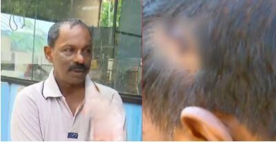 കൊല്ലത്ത് പൊറോട്ട കൊടുക്കാത്തതിന് കടയുടമയുടെ തല അടിച്ചു പൊട്ടിച്ചു; പ്രതികള്‍ക്കായി അന്വേഷണം
