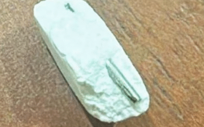 മണ്ണാര്‍ക്കാട്ട് എട്ടുവയസുകാരന് നല്‍കിയ ഗുളികയില്‍ കമ്പിക്കഷണം, പരാതി