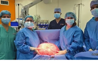 യുവതിയുടെ വയറ്റിൽ 14.5 കിലോ ഭാരമുള്ള മുഴ; ശസ്ത്രക്രിയയിലൂടെ പുറത്തെടുത്തു