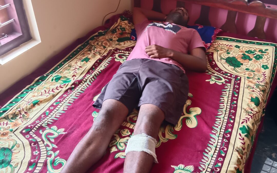 വർക്കല മാന്തറ ബീച്ചിൽ ഡ്യൂട്ടിക്കിടയിൽ ലൈഫ് ഗാർഡിനെ തെരുവ് നായ്ക്കൾ കൂട്ടത്തോടെ  ആക്രമിച്ചു