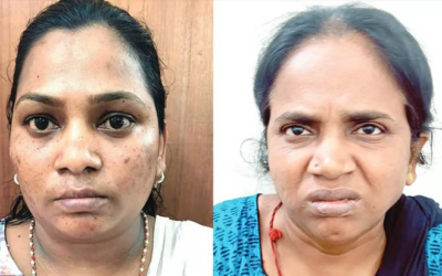 ആണ്വേഷം കെട്ടി 10 പവന് പിടിച്ചുപറിച്ചു, കിടപ്പുരോഗിയുടെ സ്വര്ണം കവര്ന്നത് ഹോം നഴ്സും സുഹൃത്തും