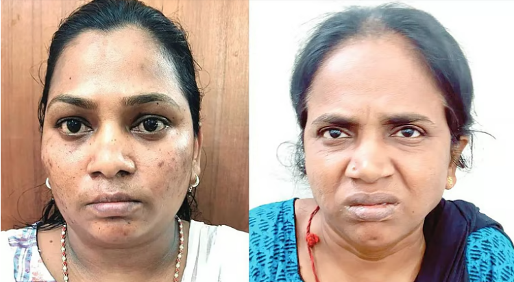 ആണ്‍വേഷം കെട്ടി 10 പവന്‍ പിടിച്ചുപറിച്ചു, കിടപ്പുരോഗിയുടെ സ്വര്‍ണം കവര്‍ന്നത് ഹോം നഴ്‌സും സുഹൃത്തും