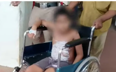ദേഹമാസകലം പൊള്ളലേറ്റ് പത്തുവയസ്സുകാരന്‍; പൊള്ളിച്ചത് അച്ഛനെന്ന് കുട്ടി