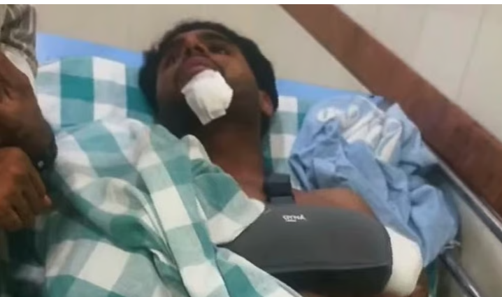 ആലുവയില്‍ നടുക്കുന്ന കവര്‍ച്ച, പ്രവാസി മലയാളിയെ തലയ്ക്ക് കല്ലെറിഞ്ഞു വീഴ്ത്തി