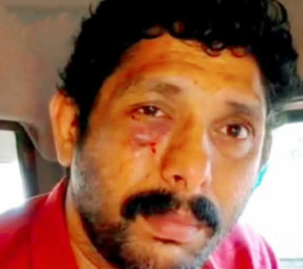 വീട്ടിലെത്തി, ആരുമില്ലെന്നറിഞ്ഞ് വെള്ളം ചോദിച്ചു; പ്രായപൂർത്തിയാകാത്ത പെൺകുട്ടിയെ പീഡിപ്പിക്കാൻ ശ്രമിച്ച 42കാരൻ പിടിയിൽ